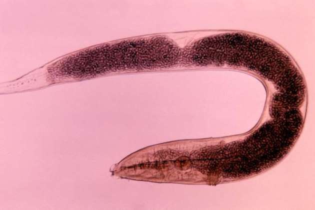 Pinworms are an extremely common type of roundworm infection, especially in children. They don’t cause lasting harm, but are difficult to eradicate. They can live outside the body on surfaces like toys, towels, pajamas and desks for two to three weeks, easily being transferred onto other little fingers and into little mouths. © Dr. Robert Calentine/Getty Images